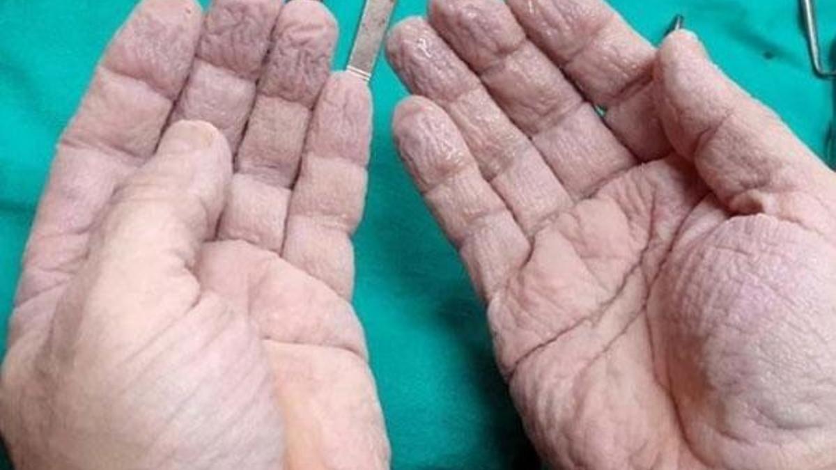 Cerrahın fotoğrafı sosyal medyayı salladı