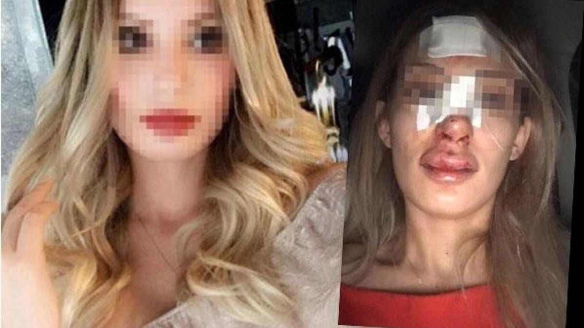 Çıplak fotoğraflı şantajın ardından darp!