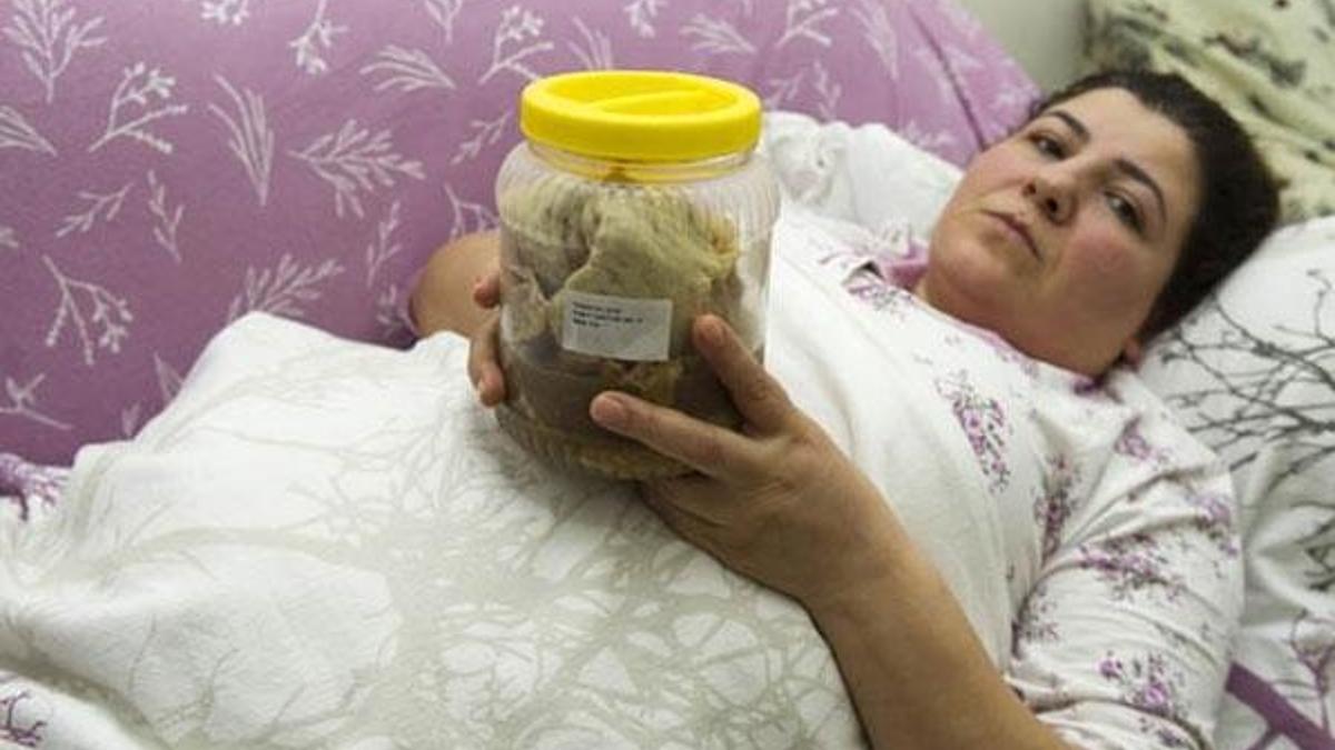 Karnında 1.8 kilo gazlı bez unutulmuştu: Hastane ve doktor suçlu çıktı