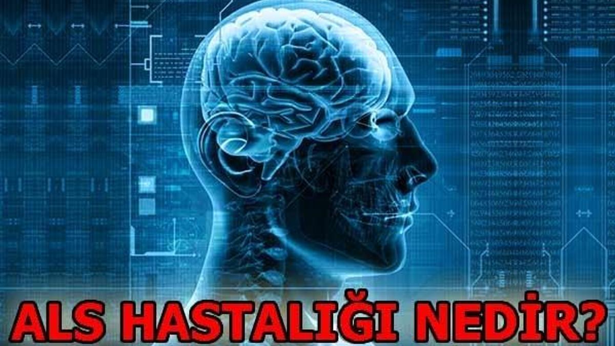 ALS hastalığı nedir? ALS belirtileri nelerdir?