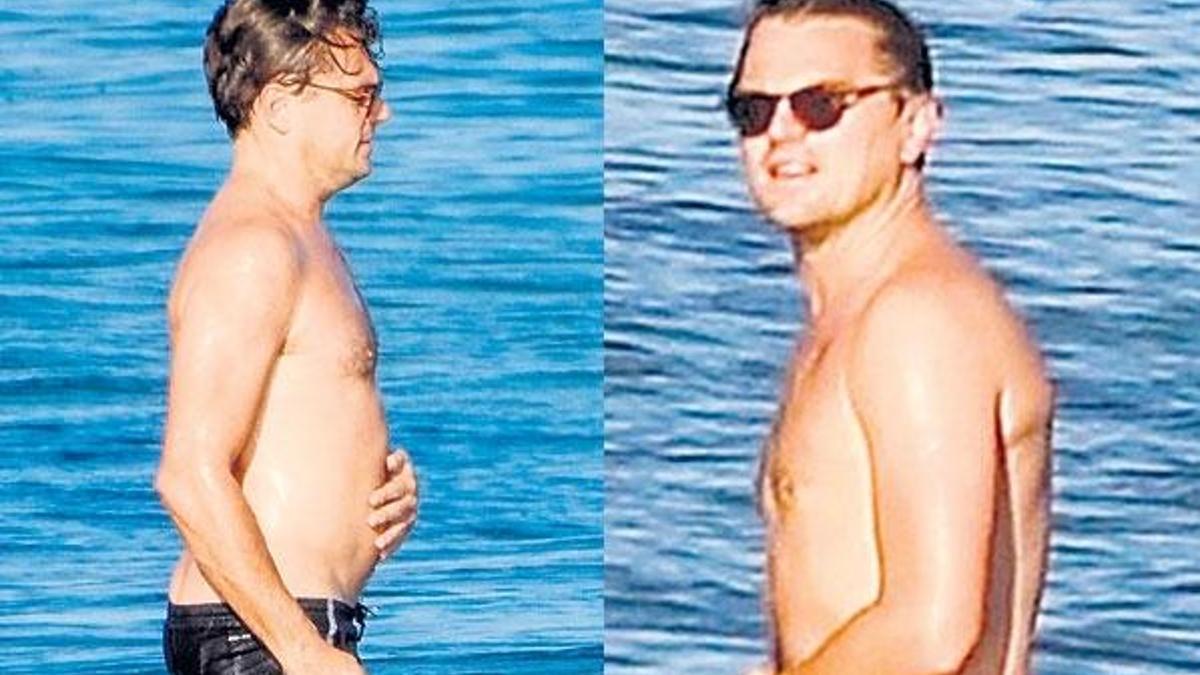 Leo’nun göbek sorunu