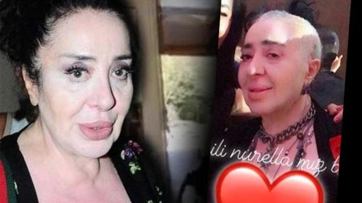 Ameliyat sonrası tanınmaz halde!