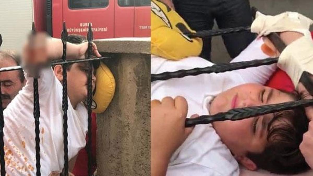 Oynarken koluna demir korkuluk saplandı!