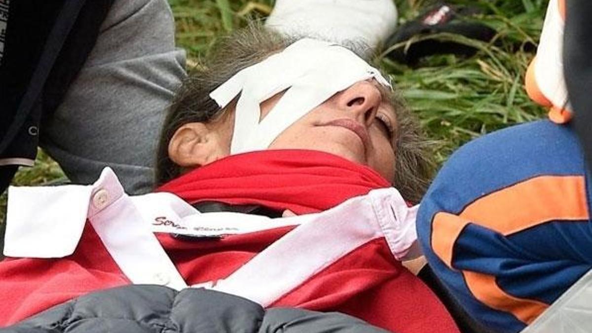 Gözüne gelen golf topu kör etti