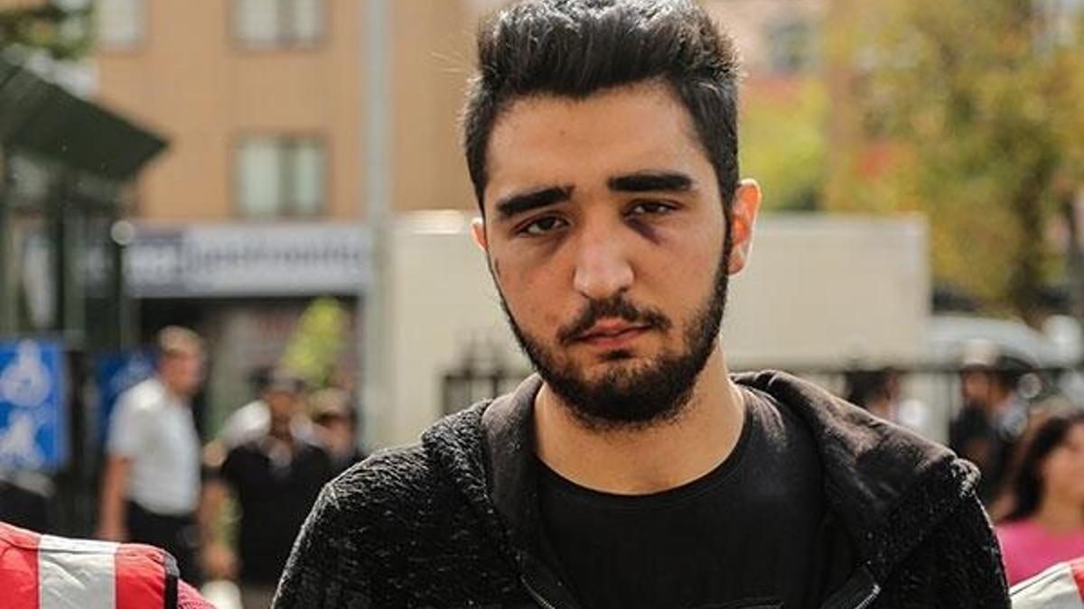 Dövdüğü sevgilisi için adam bıçaklamış