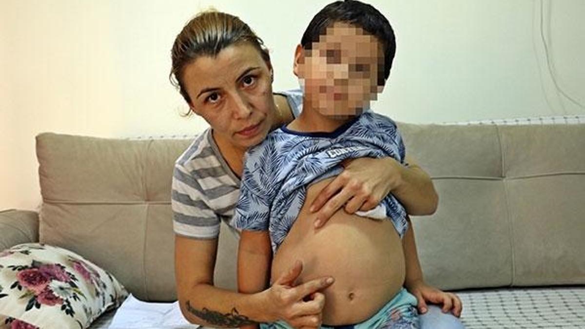 5 yaşındaki çocuğa kreşte darp iddiası