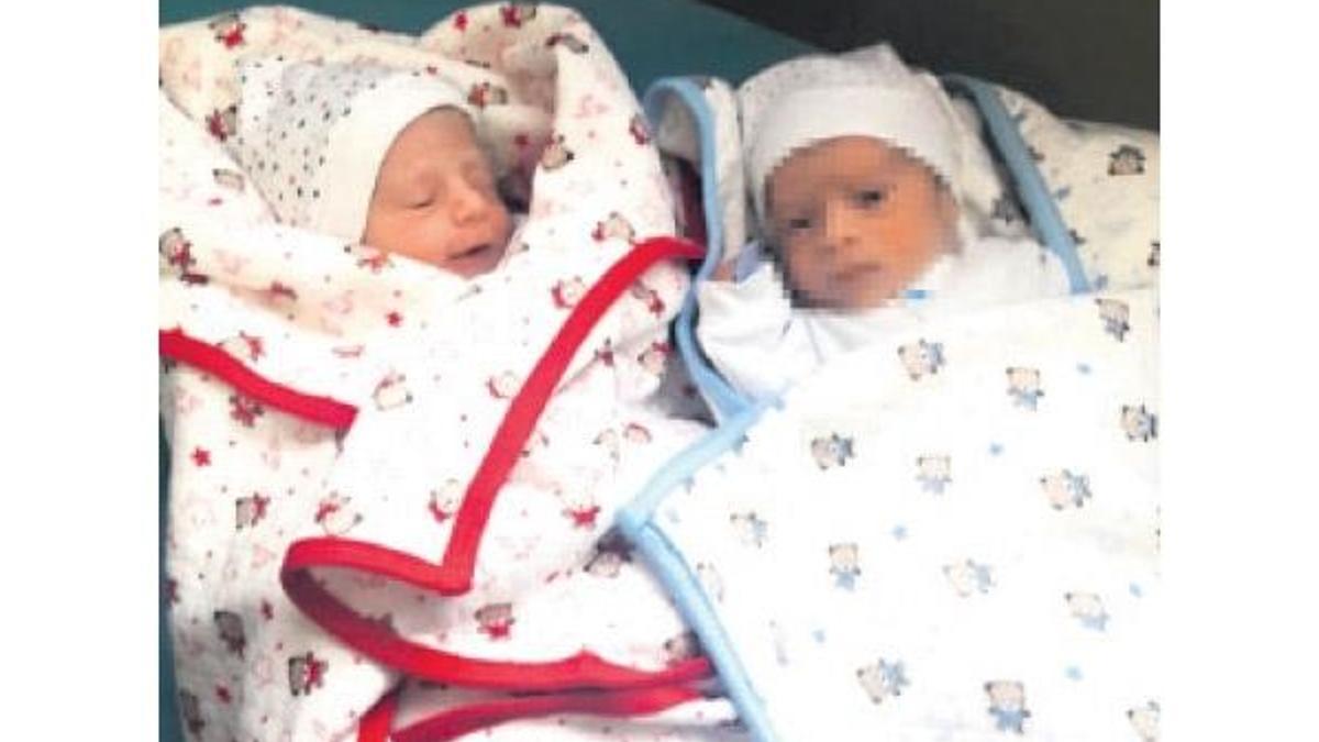 40 günlük ikizleri ihmal mi ayırdı?