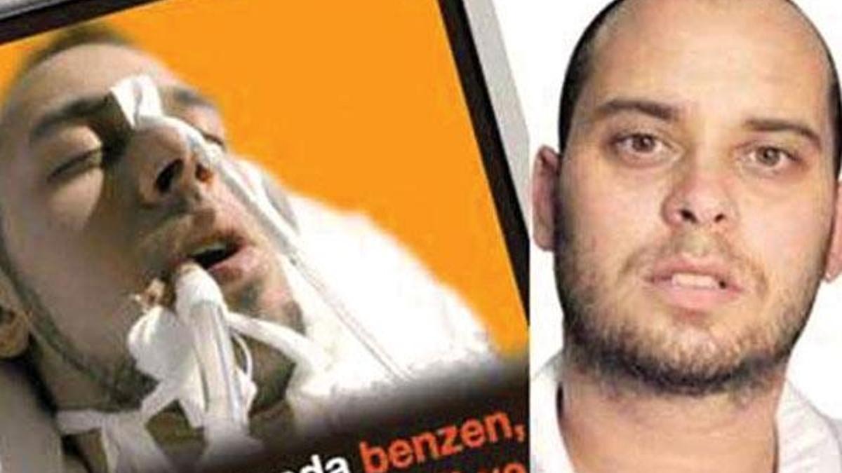 Sigara paketindeki fotoğrafa tazminat davasında karar çıktı