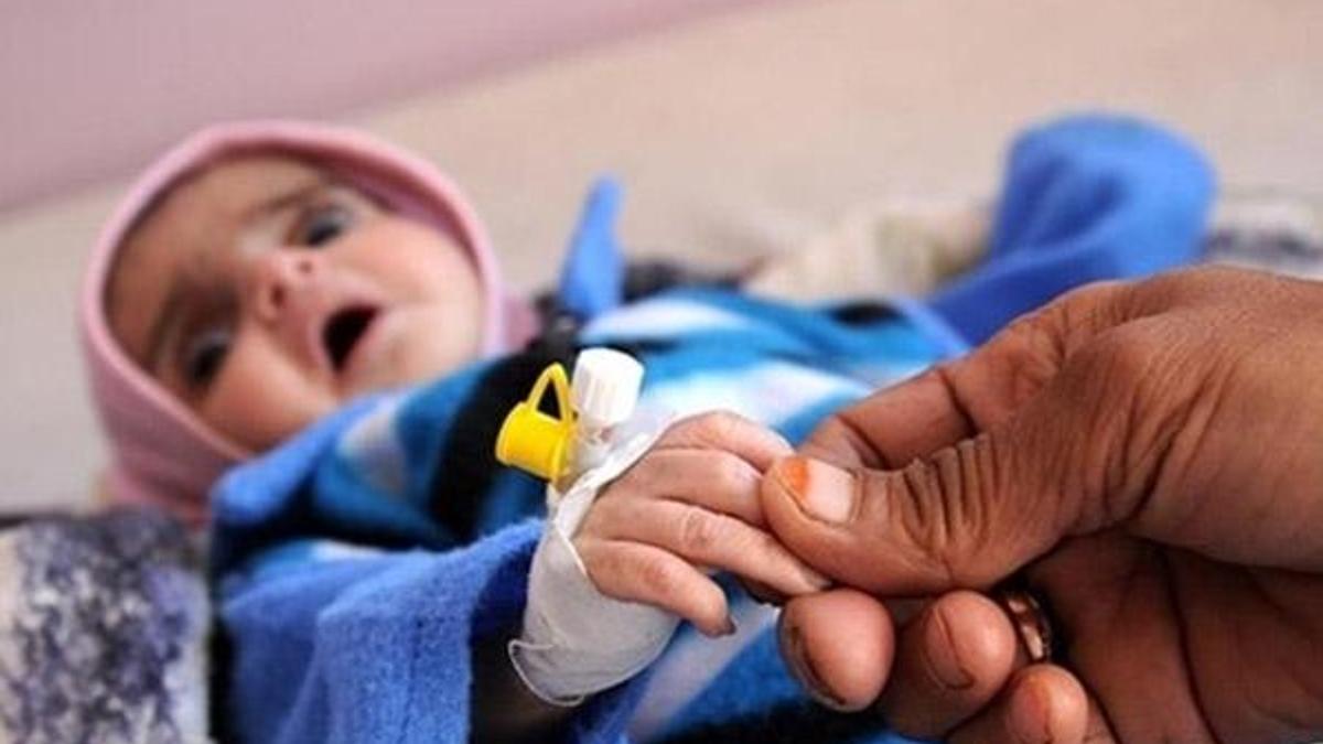 Yemen'de insanlık dramı! Her 10 dakikada 1 çocuk ölüyor