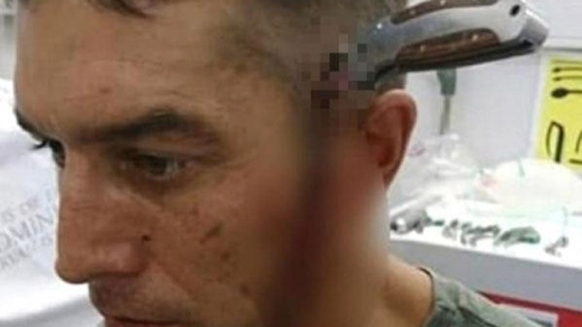 Başına bıçak saplanan adam: Müsait bir doktor var mı?