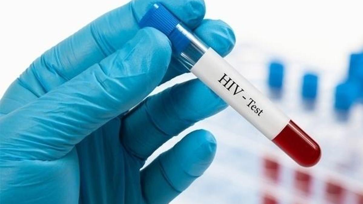 Türkiye’de HIV pozitif sayısı arttı