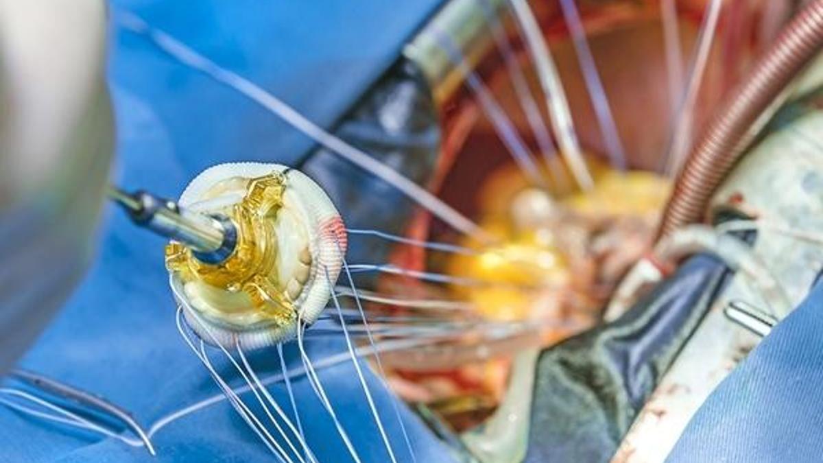 70 milyon liralık yatırımla artık Türkiye'de üretilecek!