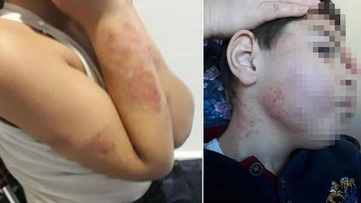 Özel rehabilitasyon merkezinde 10 yaşındaki çocuğa 'darp' iddiası