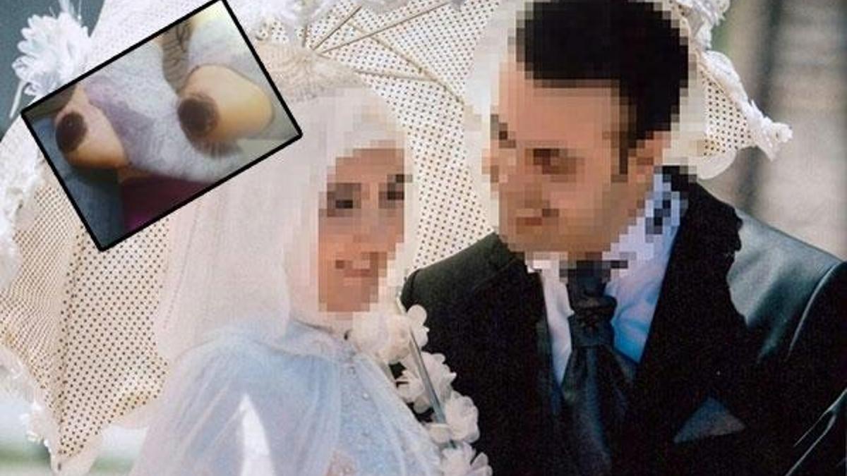'Topuk yakma' davasında 2 hemşirenin cezası belli oldu