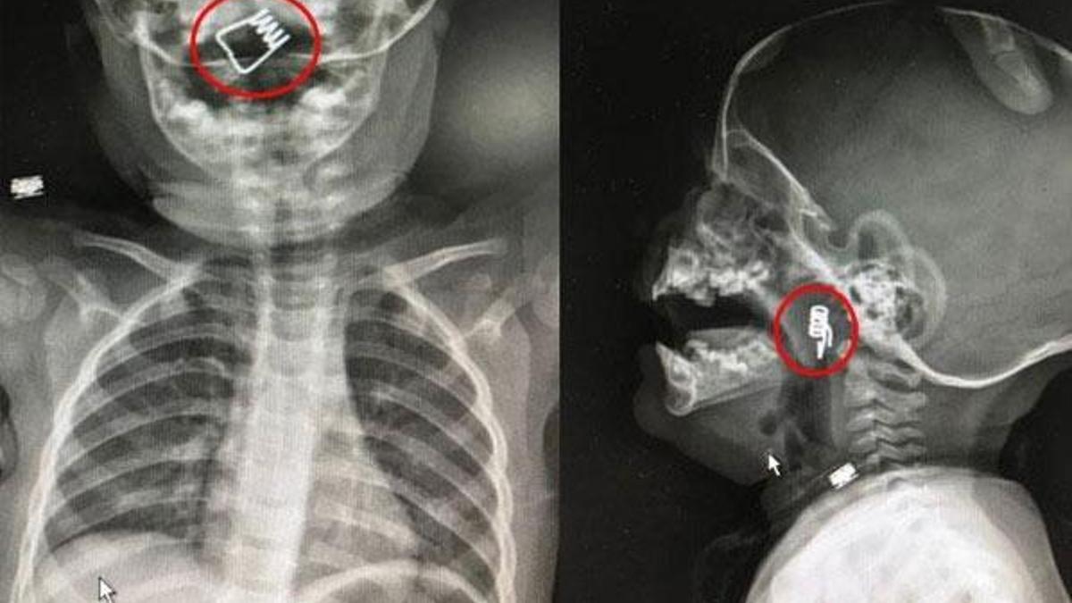 Doktor, görür görmez ameliyata aldı