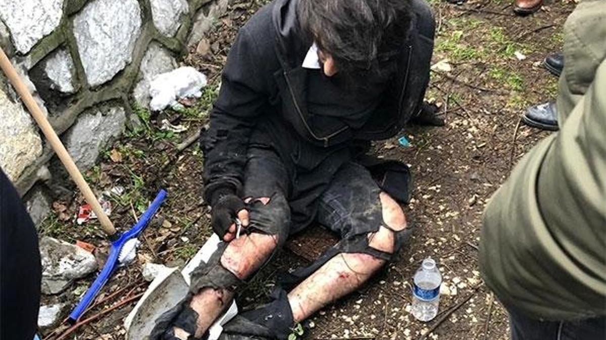 Üniversite öğrencisi köpek saldırısıyla yaralandı