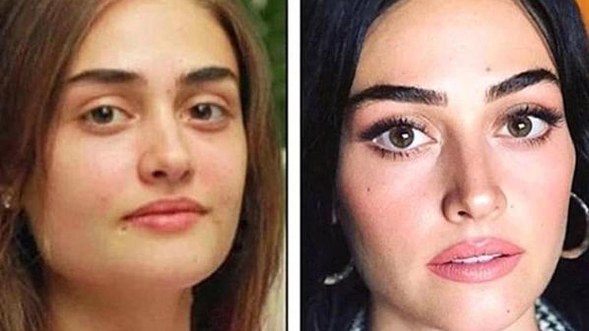 Esra Bilgiç: Estetiğe zerre kadar ihtiyacım yok!