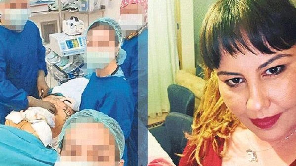 Meme küçültme ameliyatı hayatını zindana çevirdi! 'Aynada bakamaz hale geldim'