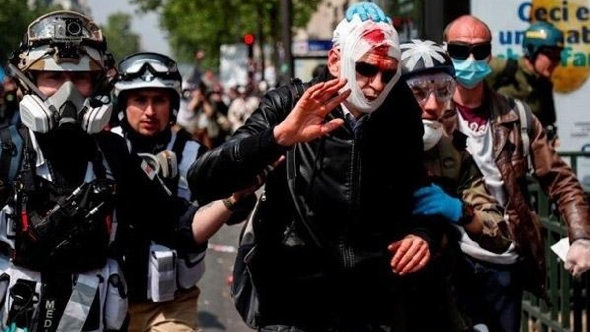 Paris sokakları karıştı! Çok sayıda yaralı var