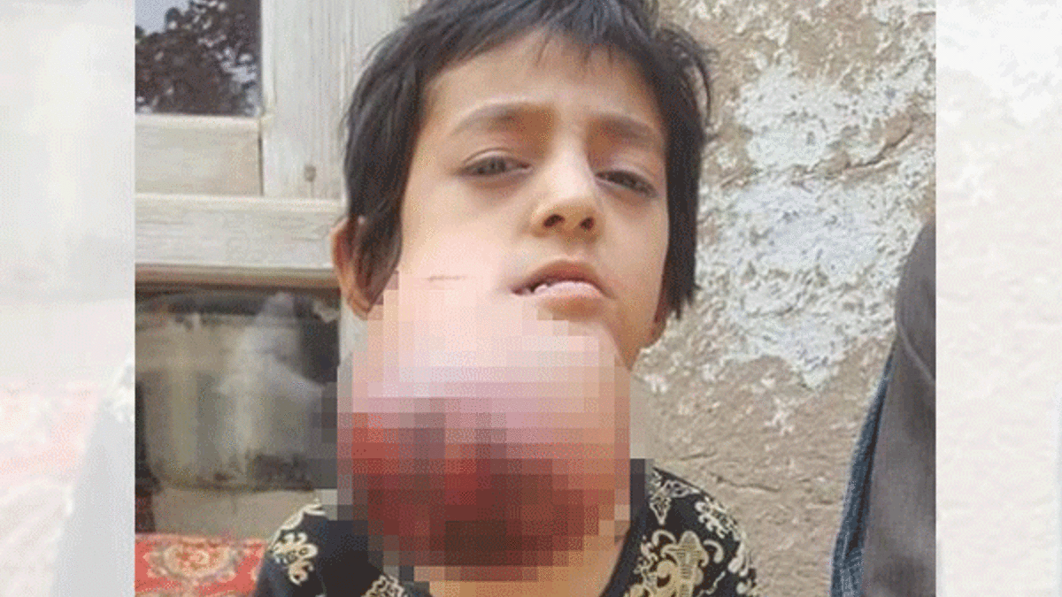 Afganistanlı küçük Habibe yardım bekliyor