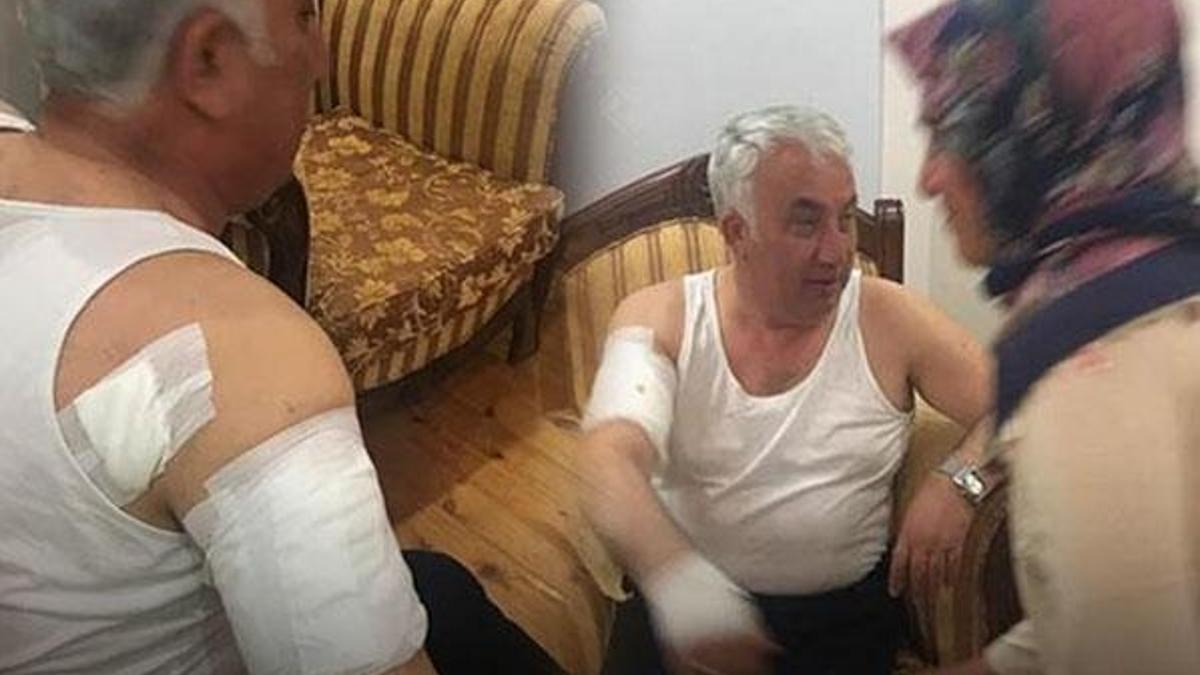 Belediye başkanına köpek saldırdı: Ucuz atlattım...