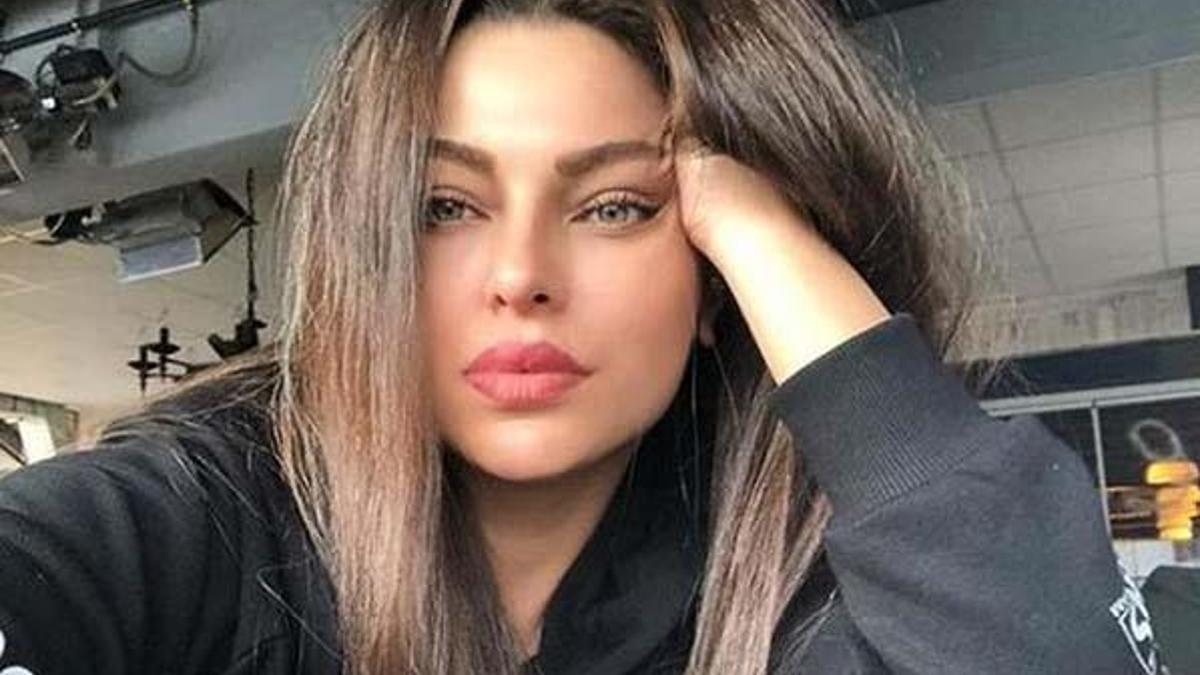 Sinem Umaş'ın kolları yandı