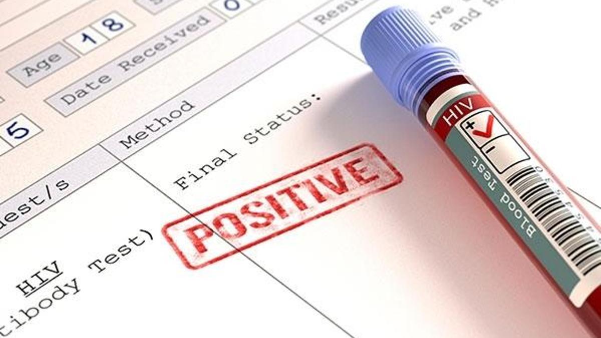 "HIV/AIDS" eğitim müfredatına girecek