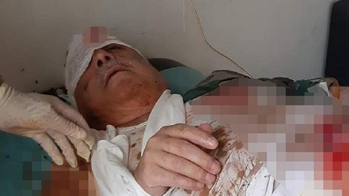 Terörist Mihraç Ural'ın patlamada yaralandığı iddia edildi