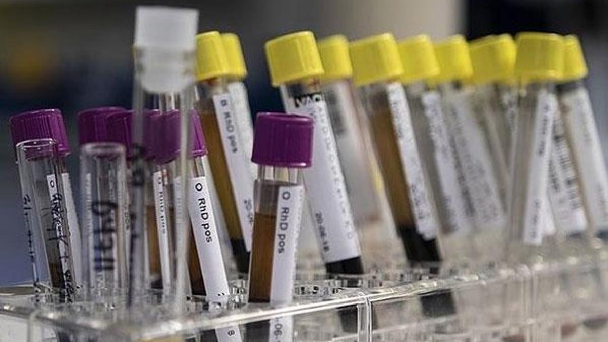 "Hepatit sebebiyle yılda 1,4 milyon kişi ölüyor"