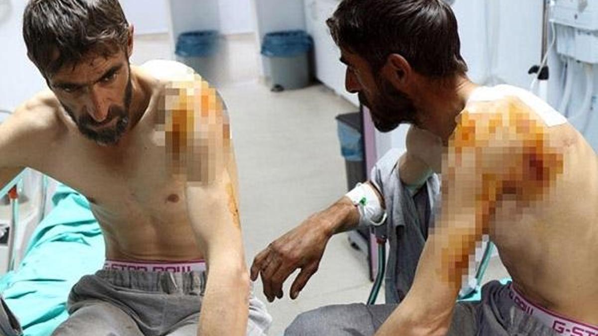 Ayı saldırısında yaralandı, asker kurtardı!