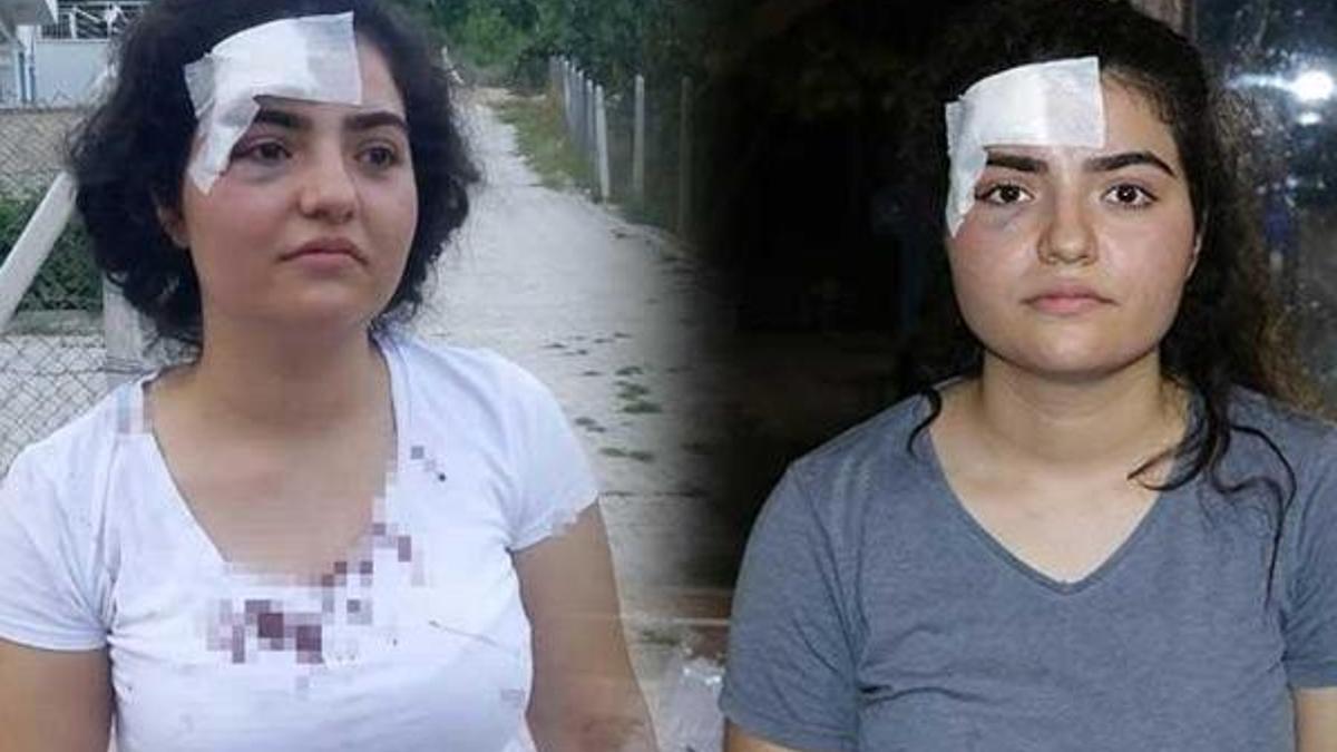 Kayıp yüzük kabusa dönüştü! 'Budaklı odunla saldırdı'