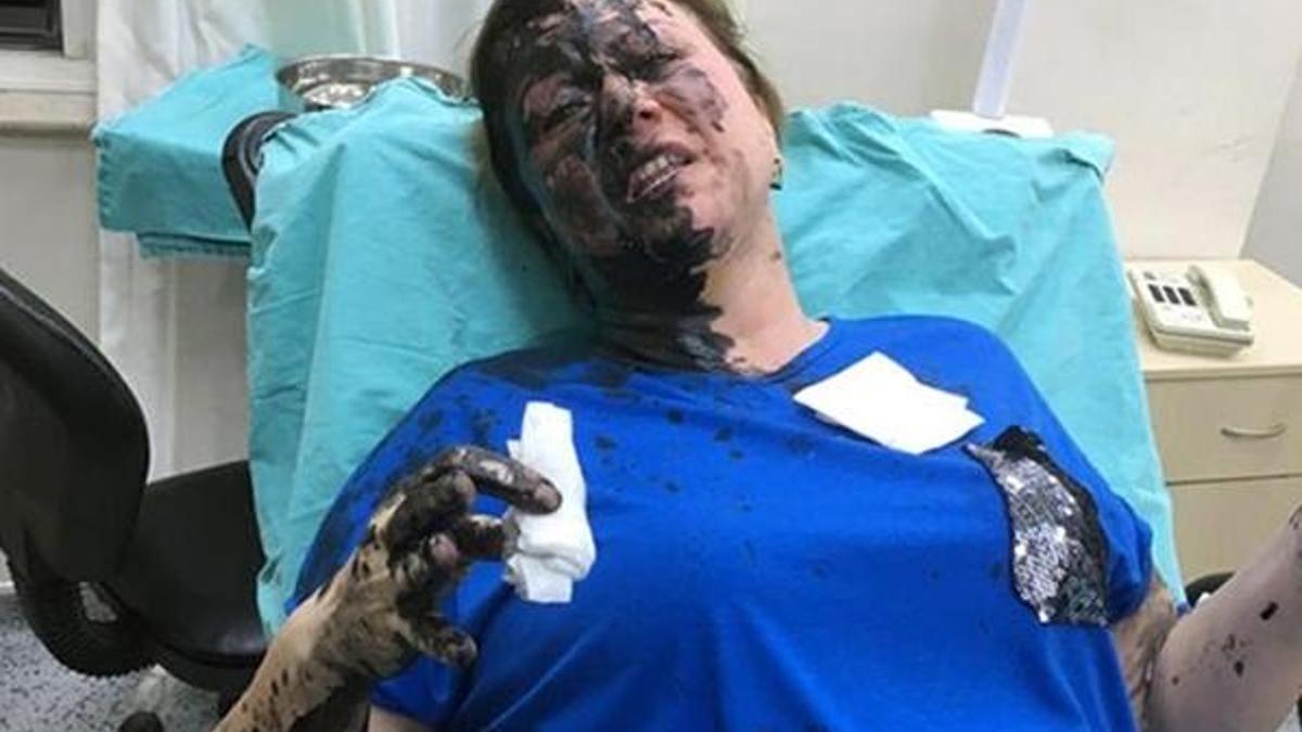 İş kadınına şok saldırı! Dövüp üzerine siyah renkli sıvı döktüler...