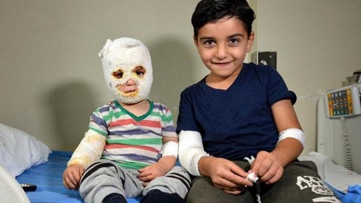 Ocaktaki çaydanlık 2 kardeşin üzerine devrildi