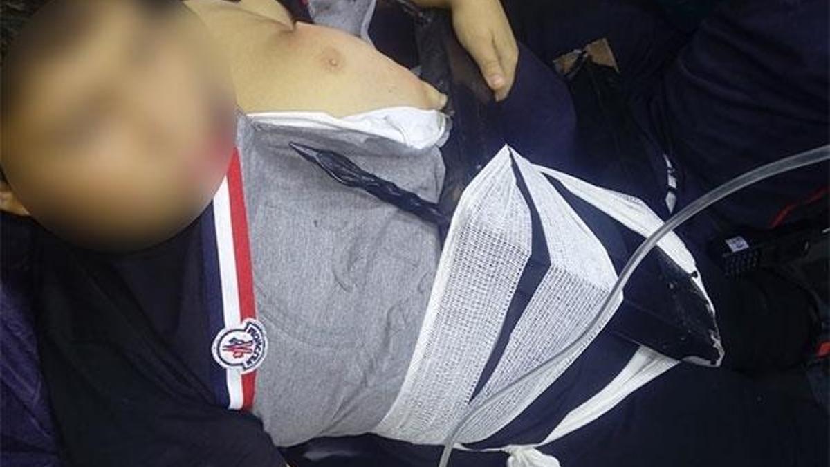 Demir korkuluklar, 10 yaşındaki çocuğun vücuduna saplandı