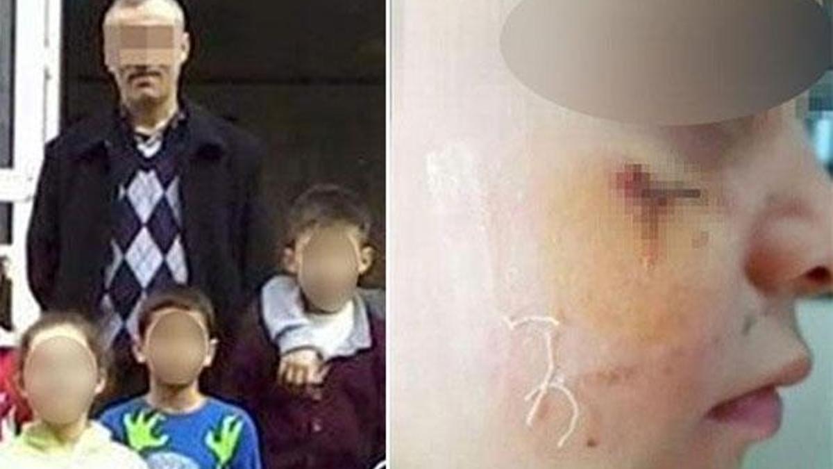 Öğrencisini kitapla yaralayan öğretmenin cezası belli oldu