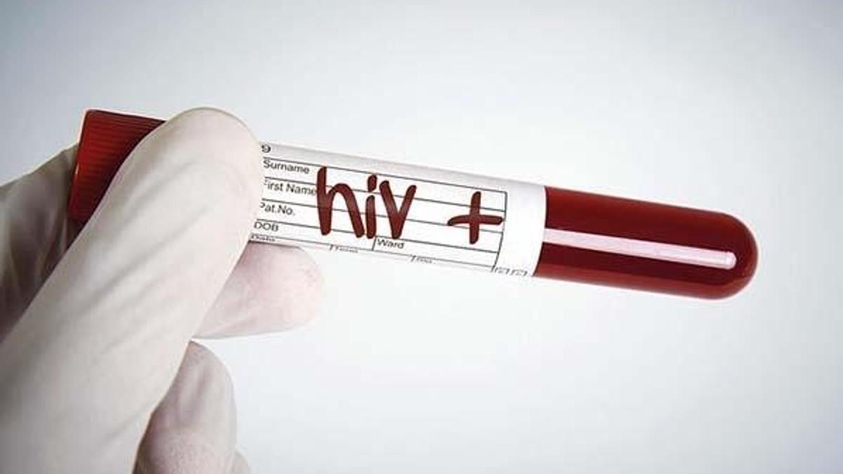 Yeni HIV türü keşfedildi