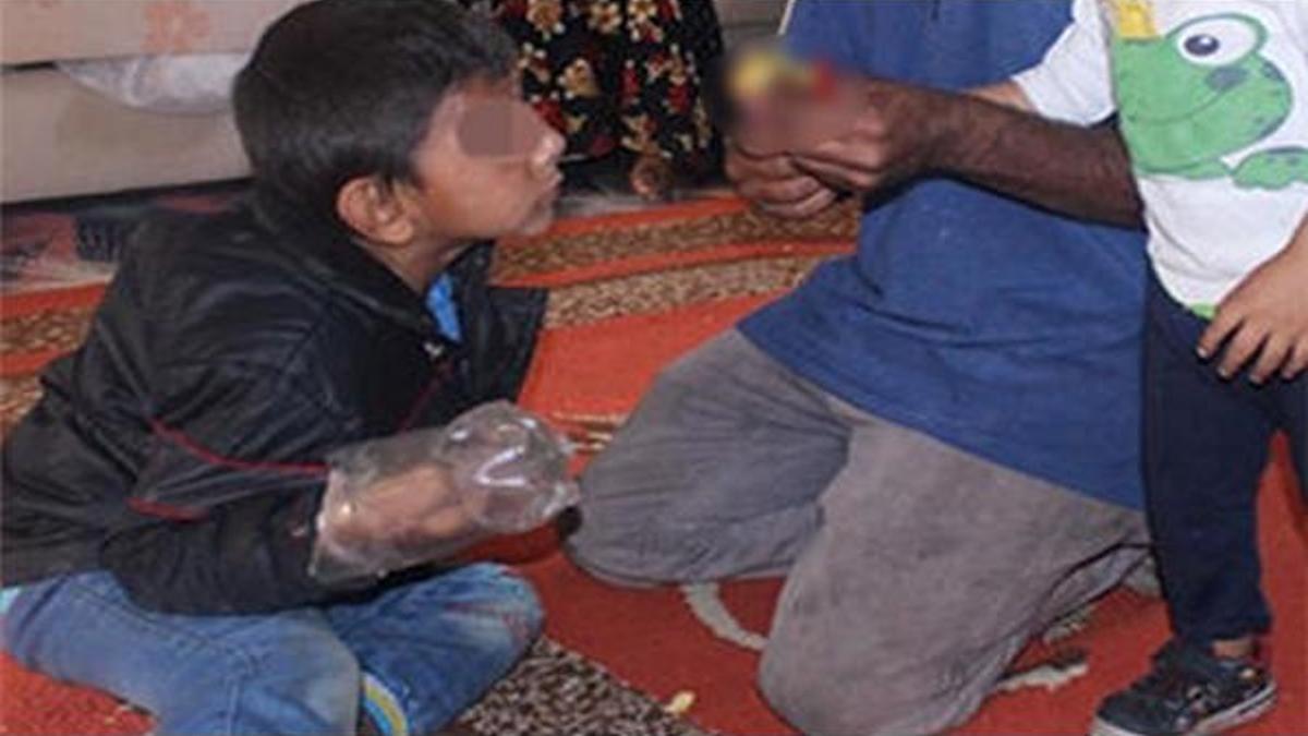 Ellerini ısırmaması için pet şişeye sokup bağlıyorlar!
