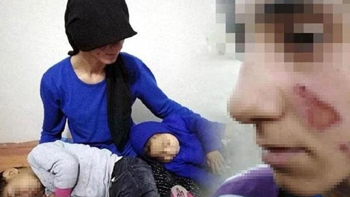 Eşinin ve 3 yaşındaki kızının yüzünü yaktı!
