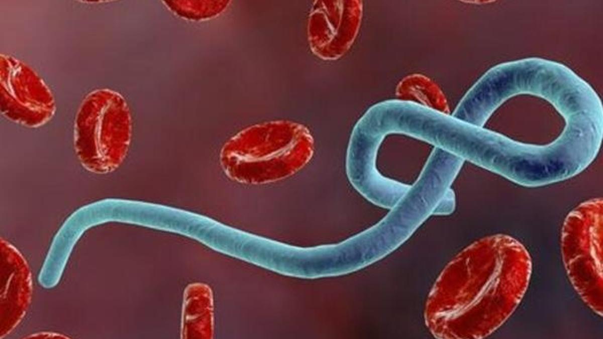 Ebola virüsü nedir? Nasıl bulaşır?