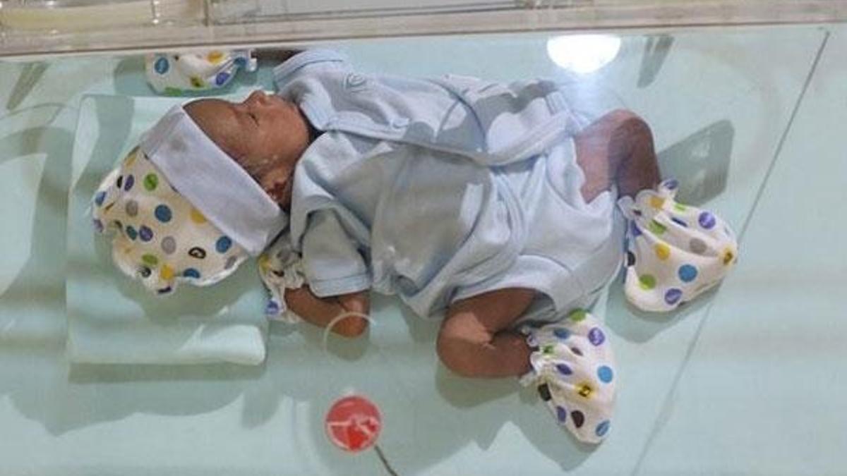 Her yıl 15 milyon bebek hayata erken başlıyor