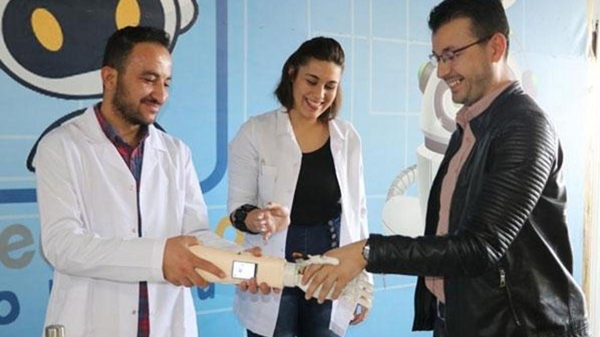 Hislere göre hareket edebilen biyonik el geliştirildi
