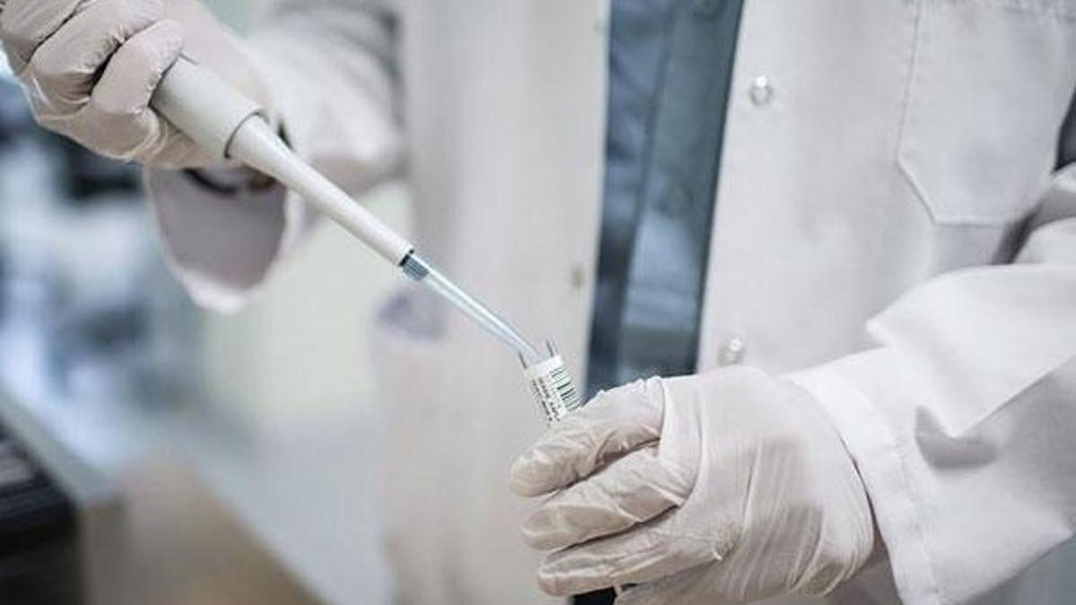 'Türkiye'de her yıl ortalama 3-4 bin kişiye AIDS tanısı konuyor'