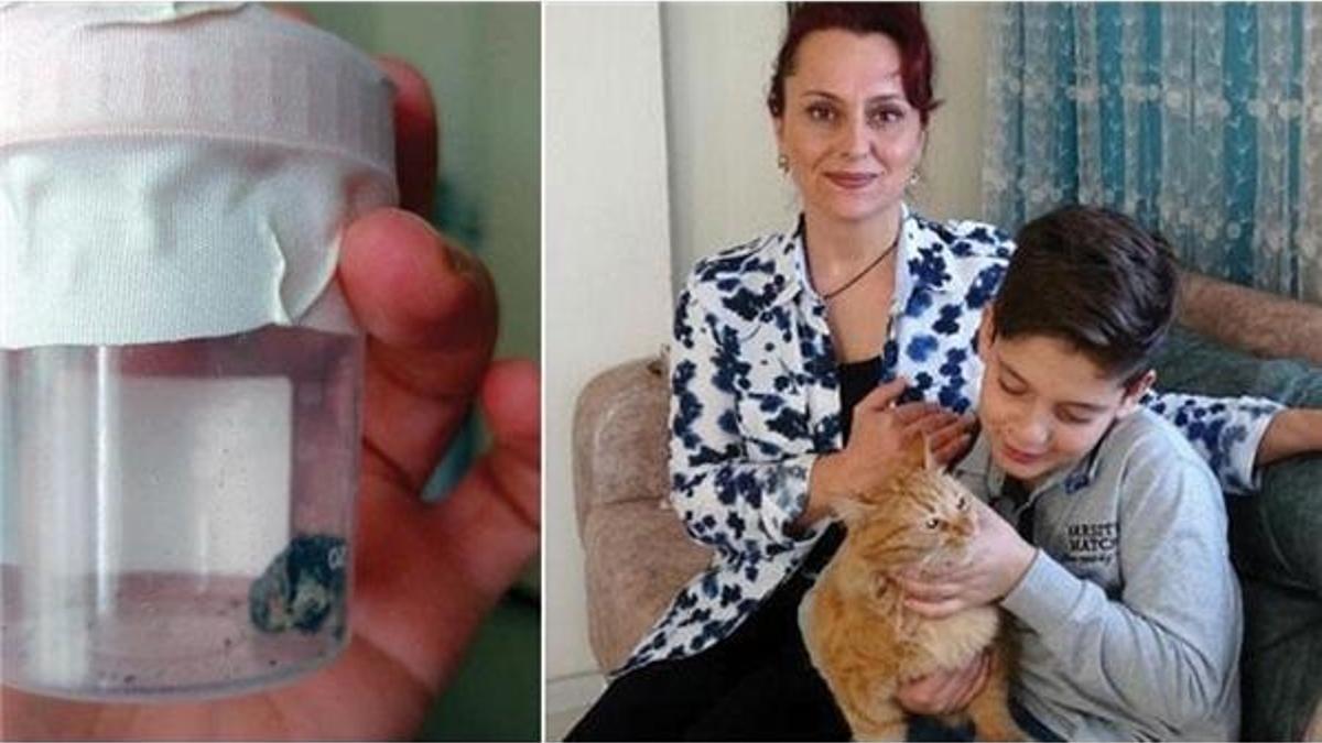 19 yıl bu kurşunla yaşadı! 3 TL'lik bir mermiyle...