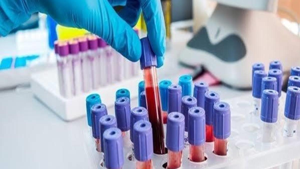 Kolanjiyo kanserlerini tetikleyen beş etken
