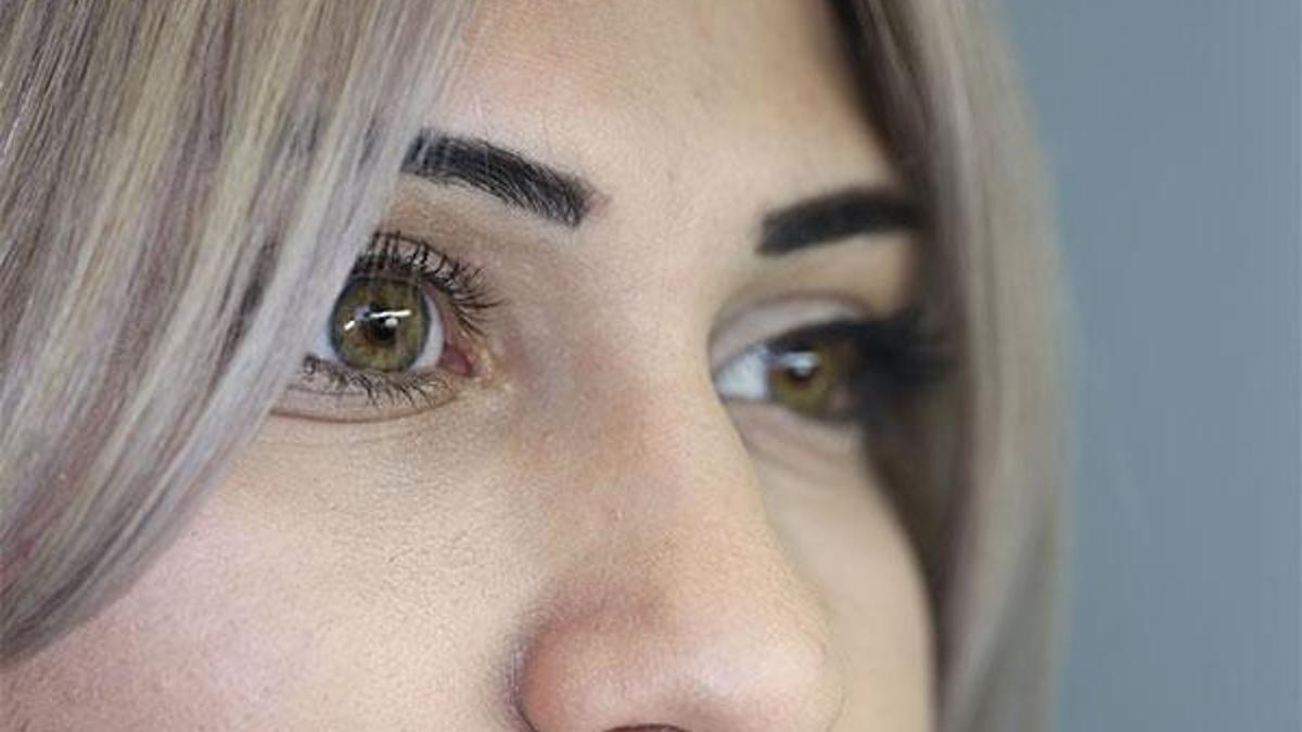 Protez göz sonrası bakıma dikkat