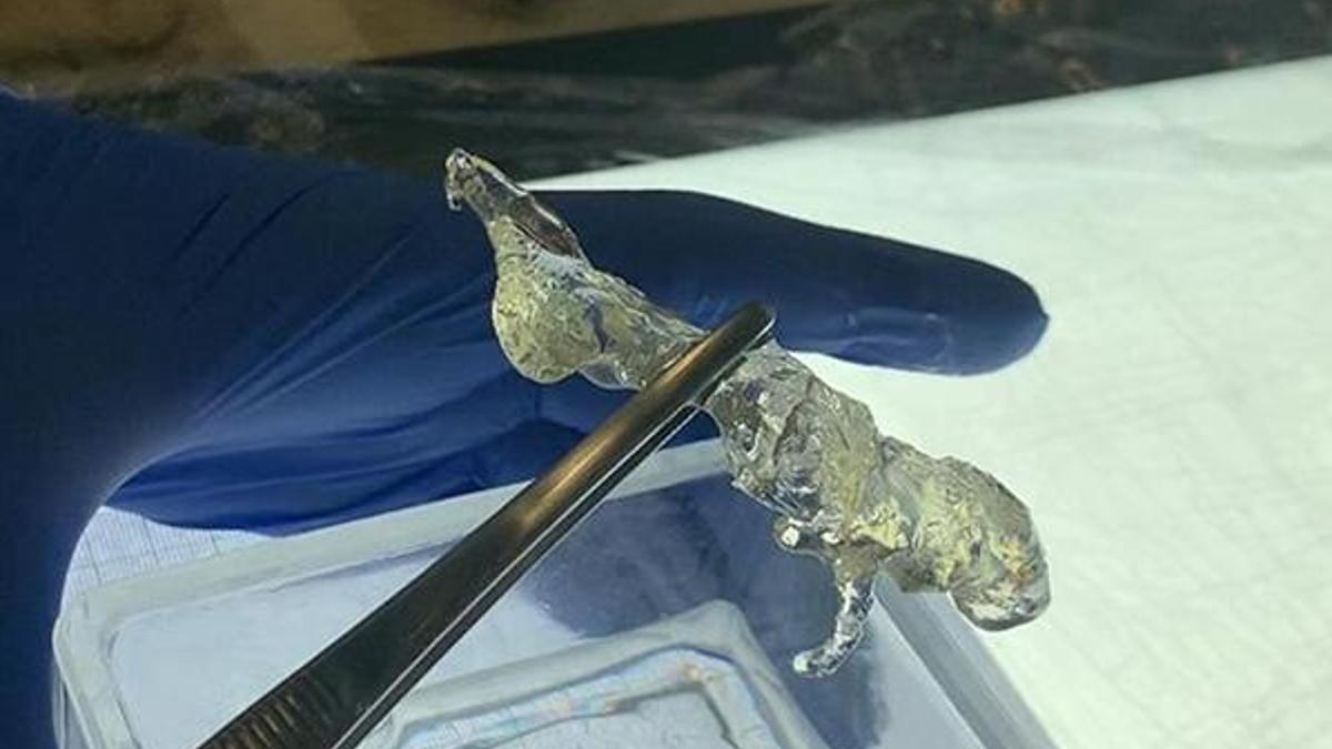 Türk doktor geliştirdi! Kansere karşı ‘en detaylı görüntüleme’