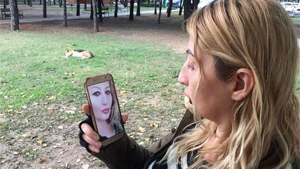 Güzellik uğruna kaybettiği alt dudağı eskisi gibi olmayacak