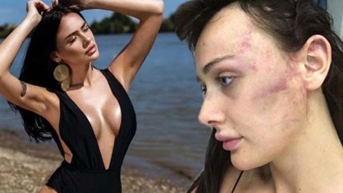 Sevgilisini dövdüğü iddia edilen yönetmen hakim karşısında!