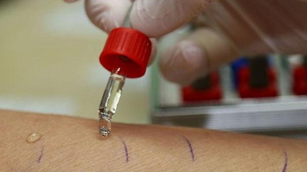 Kış mevsiminde alerjik hastalık bulguları artıyor