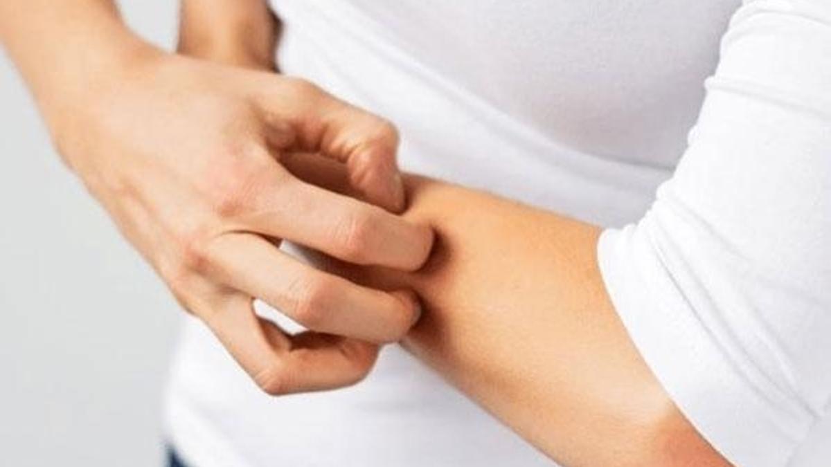 Soğuk hava egzamayı artırıyor